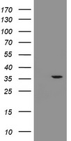 RFC2 / RFC40 Antibody - HEK293T cells were transfected with the pCMV6-ENTRY control (Left lane) or pCMV6-ENTRY RFC2 (Right lane) cDNA for 48 hrs and lysed. Equivalent amounts of cell lysates (5 ug per lane) were separated by SDS-PAGE and immunoblotted with anti-RFC2.