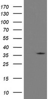 RFC2 / RFC40 Antibody - HEK293T cells were transfected with the pCMV6-ENTRY control (Left lane) or pCMV6-ENTRY RFC2 (Right lane) cDNA for 48 hrs and lysed. Equivalent amounts of cell lysates (5 ug per lane) were separated by SDS-PAGE and immunoblotted with anti-RFC2.