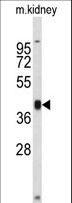 RFC3 Antibody - Western blot of RFC3 Antibody in mouse kidney tissue lysates (35 ug/lane). RFC3 (arrow) was detected using the purified antibody.