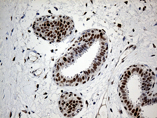 RFC3 Antibody - Immunohistochemical staining of paraffin-embedded Human breast tissue within the normal limits using anti-RFC3 mouse monoclonal antibody. (Heat-induced epitope retrieval by 1mM EDTA in 10mM Tris buffer. (pH8.5) at 120°C for 3 min. (1:500)