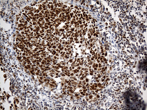RFC3 Antibody - Immunohistochemical staining of paraffin-embedded Human tonsil within the normal limits using anti-RFC3 mouse monoclonal antibody. (Heat-induced epitope retrieval by 1mM EDTA in 10mM Tris buffer. (pH8.5) at 120°C for 3 min. (1:500)