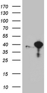 RFC3 Antibody - HEK293T cells were transfected with the pCMV6-ENTRY control. (Left lane) or pCMV6-ENTRY RFC3. (Right lane) cDNA for 48 hrs and lysed