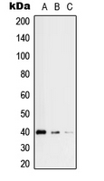 RFC3 Antibody - Western blot analysis of RFC3 expression in HeLa (A); HEK293 (B); Jurkat (C) whole cell lysates.