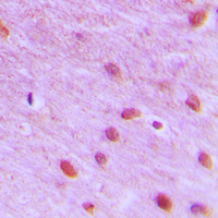 RFC3 Antibody - Immunohistochemical analysis of RFC3 staining in human brain formalin fixed paraffin embedded tissue section. The section was pre-treated using heat mediated antigen retrieval with sodium citrate buffer (pH 6.0). The section was then incubated with the antibody at room temperature and detected using an HRP conjugated compact polymer system. DAB was used as the chromogen. The section was then counterstained with hematoxylin and mounted with DPX.