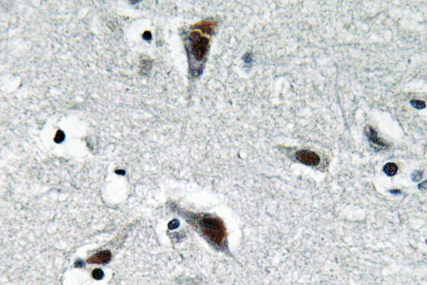 RFC3 Antibody - IHC of RFC3 (L227) pAb in paraffin-embedded human brain tissue.