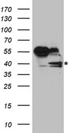RFC3 Antibody - HEK293T cells were transfected with the pCMV6-ENTRY control. (Left lane) or pCMV6-ENTRY RFC3. (Right lane) cDNA for 48 hrs and lysed