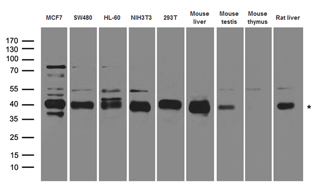 RFC3 Antibody - Western blot analysis of extracts. (35ug) from different cell lines and tissues by using anti-RFC3 rabbit polyclonal antibody.