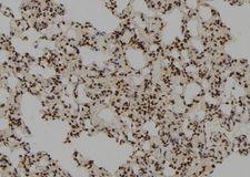 RFC3 Antibody - 1:100 staining rat lung tissue by IHC-P. The sample was formaldehyde fixed and a heat mediated antigen retrieval step in citrate buffer was performed. The sample was then blocked and incubated with the antibody for 1.5 hours at 22°C. An HRP conjugated goat anti-rabbit antibody was used as the secondary.