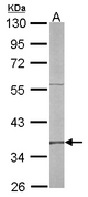 RFC4 Antibody - Sample (50 ug of whole cell lysate). A: mouse liver. 10% SDS PAGE. RFC4 antibody diluted at 1:500.