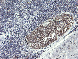 RFC4 Antibody - IHC of paraffin-embedded Human tonsil using anti-RFC4 mouse monoclonal antibody. (Heat-induced epitope retrieval by 10mM citric buffer, pH6.0, 120°C for 3min).