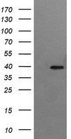 RFC4 Antibody - HEK293T cells were transfected with the pCMV6-ENTRY control (Left lane) or pCMV6-ENTRY RFC4 (Right lane) cDNA for 48 hrs and lysed. Equivalent amounts of cell lysates (5 ug per lane) were separated by SDS-PAGE and immunoblotted with anti-RFC4.