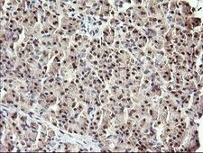 RFC4 Antibody - IHC of paraffin-embedded Human pancreas tissue using anti-RFC4 mouse monoclonal antibody. (Heat-induced epitope retrieval by 10mM citric buffer, pH6.0, 120°C for 3min).