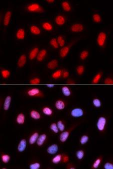 RFC4 Antibody - Immunofluorescence analysis of U20S cells.