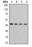 RFC4 Antibody - Western blot analysis of RFC4 expression in HeLa (A); K562 (B); HepG2 (C); MCF7 (D) whole cell lysates.