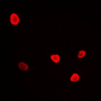 RFC4 Antibody - Immunofluorescent analysis of RFC4 staining in U2OS cells. Formalin-fixed cells were permeabilized with 0.1% Triton X-100 in TBS for 5-10 minutes and blocked with 3% BSA-PBS for 30 minutes at room temperature. Cells were probed with the primary antibody in 3% BSA-PBS and incubated overnight at 4 deg C in a humidified chamber. Cells were washed with PBST and incubated with a DyLight 594-conjugated secondary antibody (red) in PBS at room temperature in the dark.