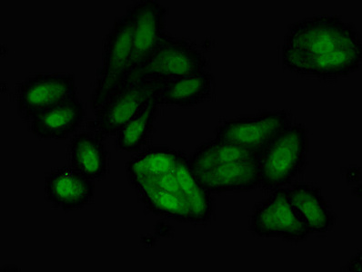 RFC4 Antibody - Immunofluorescent analysis of HepG2 cells diluted at 1:100 and Alexa Fluor 488-congugated AffiniPure Goat Anti-Rabbit IgG(H+L)