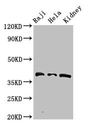 RFC4 Antibody - Western Blot Positive WB detected in:Raji whole cell lysate,Hela whole cell lysate,Mouse kidney tissue All Lanes:RFC4 antibody at 2.7µg/ml Secondary Goat polyclonal to rabbit IgG at 1/50000 dilution Predicted band size: 40,34 KDa Observed band size: 40 KDa