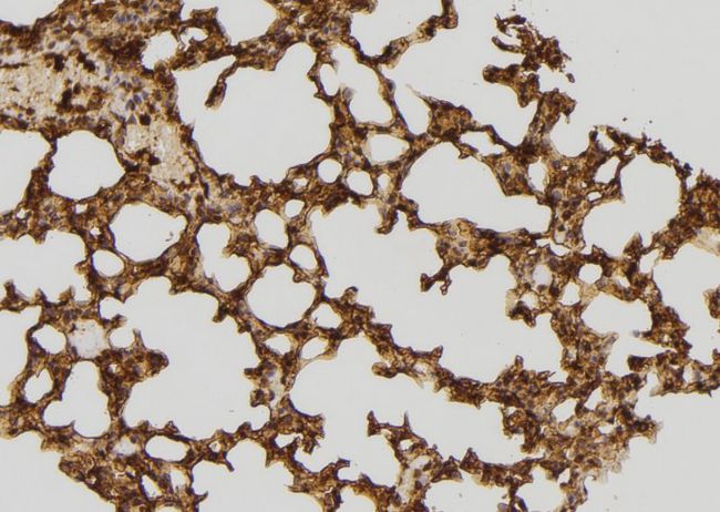 RFC4 Antibody - 1:100 staining mouse lung tissue by IHC-P. The sample was formaldehyde fixed and a heat mediated antigen retrieval step in citrate buffer was performed. The sample was then blocked and incubated with the antibody for 1.5 hours at 22°C. An HRP conjugated goat anti-rabbit antibody was used as the secondary.