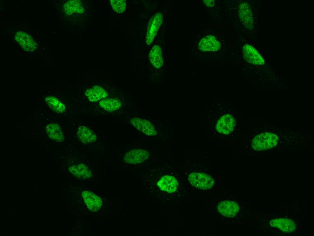 RFC4 Antibody - Immunofluorescence staining of RFC4 in U2OS cells. Cells were fixed with 4% PFA, permeabilzed with 0.1% Triton X-100 in PBS, blocked with 10% serum, and incubated with rabbit anti-Human RFC4 polyclonal antibody (dilution ratio 1:200) at 4°C overnight. Then cells were stained with the Alexa Fluor 488-conjugated Goat Anti-rabbit IgG secondary antibody (green). Positive staining was localized to Nucleus.