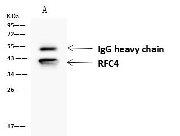 RFC4 Antibody - RFC4 was immunoprecipitated using: Lane A: 0.5 mg Jurkat Whole Cell Lysate. 4 uL anti-RFC4 rabbit polyclonal antibody and 60 ug of Immunomagnetic beads Protein A/G. Primary antibody: Anti-RFC4 rabbit polyclonal antibody, at 1:100 dilution. Secondary antibody: Goat Anti-Rabbit IgG (H+L)/HRP at 1/10000 dilution. Developed using the ECL technique. Performed under reducing conditions. Predicted band size: 40 kDa. Observed band size: 40 kDa.