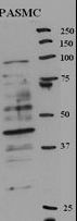RFC5 Antibody - Western blot of anti-RFC5 Antibody (Center R185) in rat PASMC cell line lysates (35 ug/lane). RFC5(arrow) was detected using the purified antibody( Provided by Hirotaka Ata).