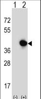 RFC5 Antibody - Western blot of RFC5 (arrow) using rabbit polyclonal RFC5 Antibody (Center R185). 293 cell lysates (2 ug/lane) either nontransfected (Lane 1) or transiently transfected (Lane 2) with the RFC5 gene.