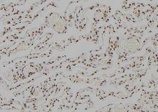 RFC5 Antibody - 1:100 staining human lung tissue by IHC-P. The sample was formaldehyde fixed and a heat mediated antigen retrieval step in citrate buffer was performed. The sample was then blocked and incubated with the antibody for 1.5 hours at 22°C. An HRP conjugated goat anti-rabbit antibody was used as the secondary.
