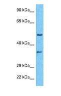 RFC5 Antibody - Western blot of RFC5 Antibody with human HeLa Whole Cell lysate.  This image was taken for the unconjugated form of this product. Other forms have not been tested.