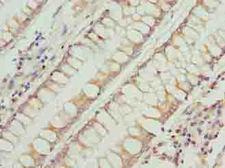 RFESD Antibody - Immunohistochemistry of paraffin-embedded human colon cancer using antibody at dilution of 1:100.