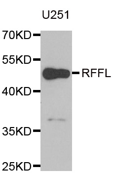 RFFL Antibody - Western blot analysis of extracts of U251 cells.