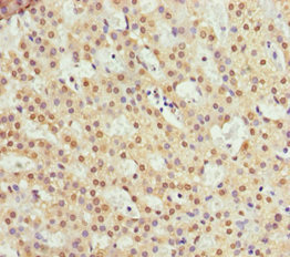 RFFL Antibody - Immunohistochemistry of paraffin-embedded human adrenal gland tissue at dilution 1:100