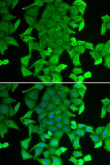 RFFL Antibody - Immunofluorescence analysis of MCF-7 cells using RFFL Polyclonal Antibody.