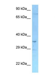 RFFL Antibody - RFFL antibody Western blot of Mouse Liver lysate. Antibody concentration 1 ug/ml.  This image was taken for the unconjugated form of this product. Other forms have not been tested.