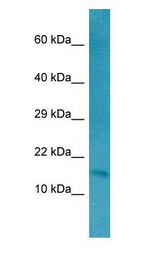 RFK Antibody - RFK antibody Western Blot of HepG2.  This image was taken for the unconjugated form of this product. Other forms have not been tested.