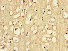 RFK Antibody - Immunohistochemistry of paraffin-embedded human brain tissue using RFK Antibody at dilution of 1:100
