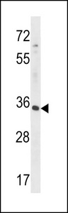 RFNG Antibody - RFNG Antibody western blot of HepG2 cell line lysates (35 ug/lane). The RFNG antibody detected the RFNG protein (arrow).