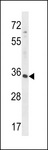 RFNG Antibody - RFNG Antibody western blot of HepG2 cell line lysates (35 ug/lane). The RFNG antibody detected the RFNG protein (arrow).