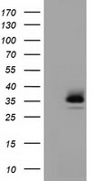 RFPL1 Antibody - HEK293T cells were transfected with the pCMV6-ENTRY control (Left lane) or pCMV6-ENTRY RFPL1 (Right lane) cDNA for 48 hrs and lysed. Equivalent amounts of cell lysates (5 ug per lane) were separated by SDS-PAGE and immunoblotted with anti-RFPL1.