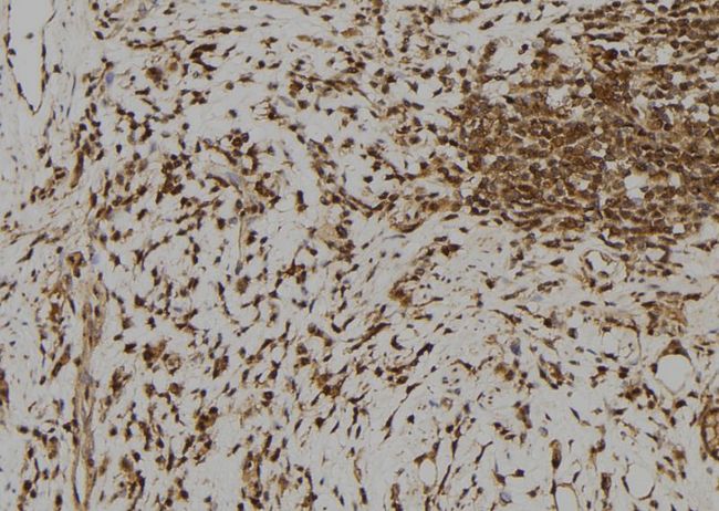 RFPL1 Antibody - 1:100 staining human gastric tissue by IHC-P. The sample was formaldehyde fixed and a heat mediated antigen retrieval step in citrate buffer was performed. The sample was then blocked and incubated with the antibody for 1.5 hours at 22°C. An HRP conjugated goat anti-rabbit antibody was used as the secondary.
