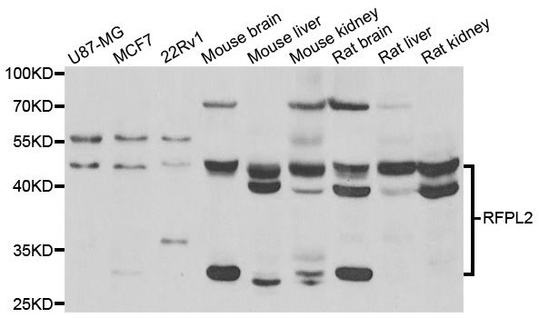 RFPL2 Antibody - Western blot analysis of extracts of various cell lines.