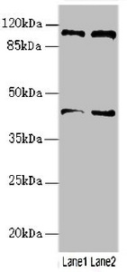 RFPL2 Antibody - Western blot All Lanes:RFPL2 antibody at 3.41ug/ml Lane 1 : U87 whole cell lysate Lane 2 : MCF7 whole cell lysate Secondary Goat polyclonal to Rabbit IgG at 1/10000 dilution Predicted band size: 43,33,36 kDa Observed band size: 42 kDa