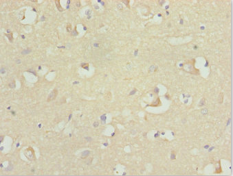 RFPL2 Antibody - Immunohistochemistry of paraffin-embedded human brain tissue at dilution 1:100