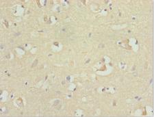 RFPL2 Antibody - Immunohistochemistry of paraffin-embedded human brain tissue at dilution 1:100