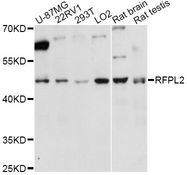 RFPL2 Antibody - Western blot analysis of extracts of various cell lines, using RFPL2 antibody at 1:3000 dilution. The secondary antibody used was an HRP Goat Anti-Rabbit IgG (H+L) at 1:10000 dilution. Lysates were loaded 25ug per lane and 3% nonfat dry milk in TBST was used for blocking. An ECL Kit was used for detection and the exposure time was 30s.
