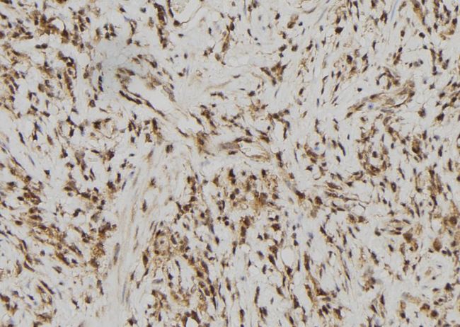 RFPL2 Antibody - 1:100 staining human gastric tissue by IHC-P. The sample was formaldehyde fixed and a heat mediated antigen retrieval step in citrate buffer was performed. The sample was then blocked and incubated with the antibody for 1.5 hours at 22°C. An HRP conjugated goat anti-rabbit antibody was used as the secondary.