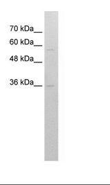 RFPL3 Antibody - HepG2 Cell Lysate.  This image was taken for the unconjugated form of this product. Other forms have not been tested.
