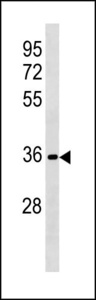 RFPL3 Antibody - RFPL3 Antibody western blot of HL-60 cell line lysates (35 ug/lane). The RFPL3 antibody detected the RFPL3 protein (arrow).