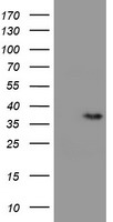 RFPL3 Antibody - HEK293T cells were transfected with the pCMV6-ENTRY control (Left lane) or pCMV6-ENTRY RFPL3 (Right lane) cDNA for 48 hrs and lysed. Equivalent amounts of cell lysates (5 ug per lane) were separated by SDS-PAGE and immunoblotted with anti-RFPL3.