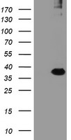 RFPL3 Antibody - HEK293T cells were transfected with the pCMV6-ENTRY control (Left lane) or pCMV6-ENTRY RFPL3 (Right lane) cDNA for 48 hrs and lysed. Equivalent amounts of cell lysates (5 ug per lane) were separated by SDS-PAGE and immunoblotted with anti-RFPL3.