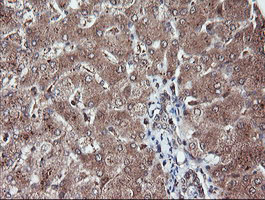 RFPL3 Antibody - IHC of paraffin-embedded Human liver tissue using anti-RFPL3 mouse monoclonal antibody.